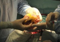 Ученые намерены напечатать на 3D-принтера живое человеческое сердце Ученые намерены напечатать на 3D-принтера живое человеческое сердце